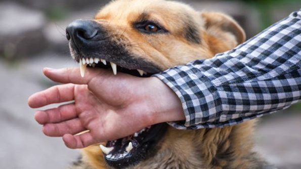 Dog_Bite